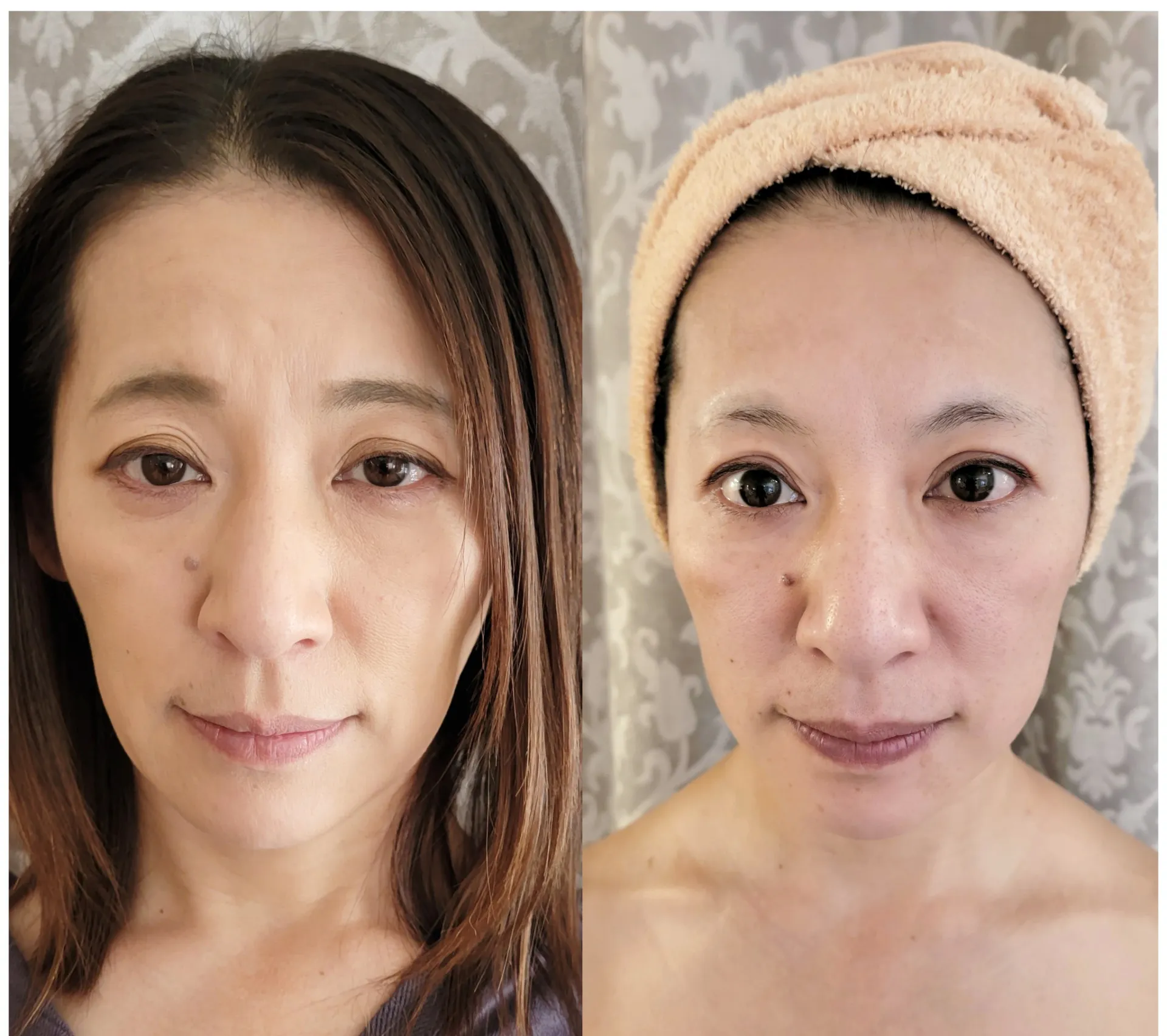 40代女性の方で「小顔効果」を目的にご来店されました!神戸市のエステサロン「bisMaquillage」